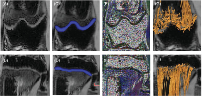 MRM-29432-FIG-0001-c