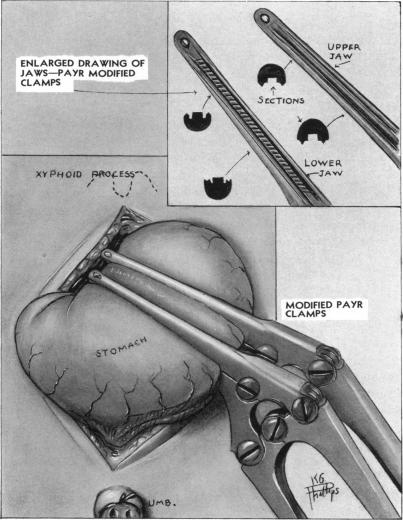 FIG. 1.