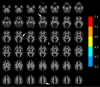 Fig. 11