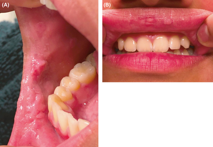 FIGURE 3