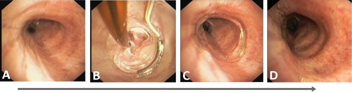 Figure 4