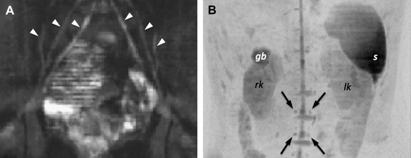 Figure 31