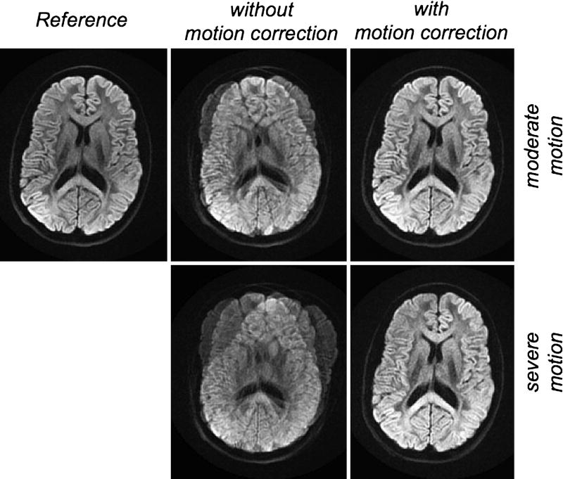 Figure 22