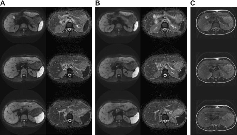 Figure 21