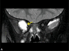 Figure 2(A)