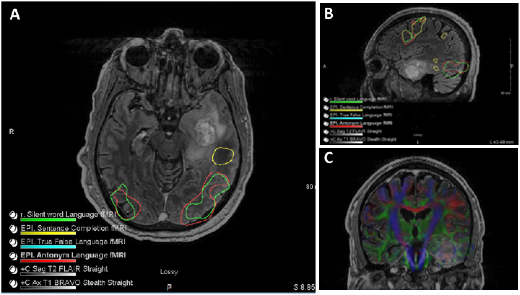 Figure 2: