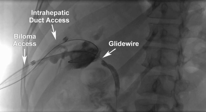 Fig. 3