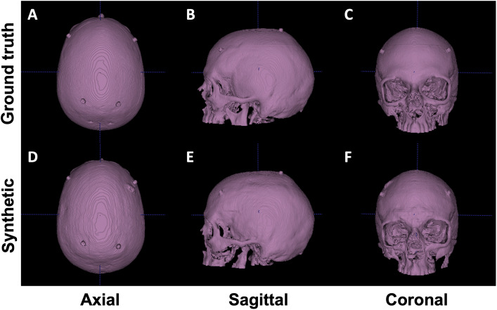 Fig. 4