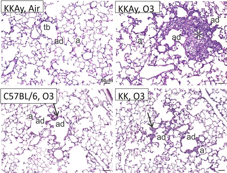 Figure 4 is a set of four light photomicrographs of centriacinar lesions, namely, K K A y after air, K K A y after ozone, uppercase C 57 black 6 after ozone, and K K after ozone. In the light photomicrographs, three tissues stained with hematoxylin and eosin, namely, terminal bronchiole, alveolar duct, and alveolus can be seen.