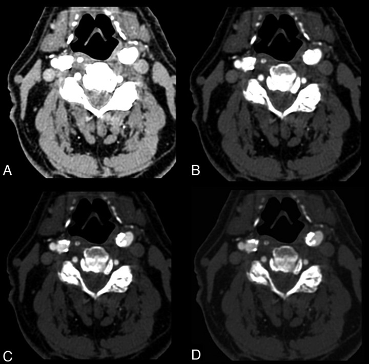 Fig 3.