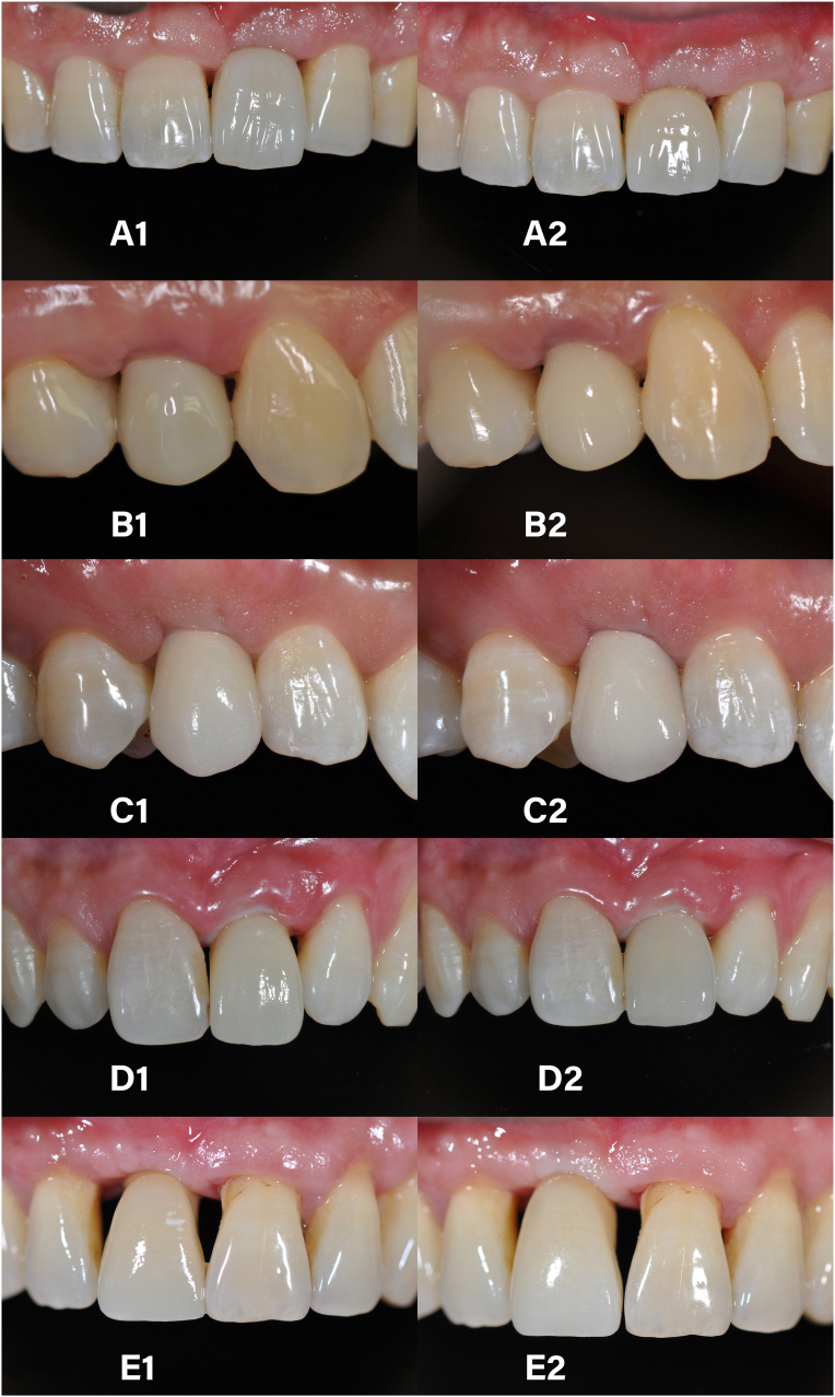 Figure 4