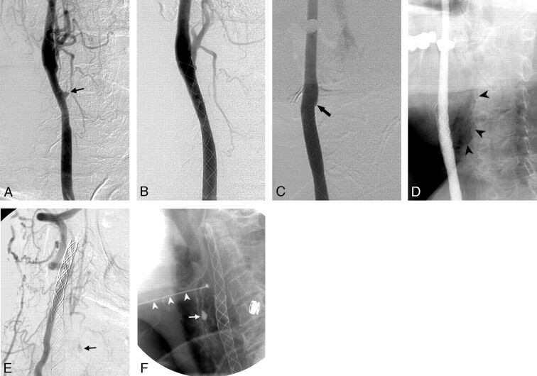 Fig 4.