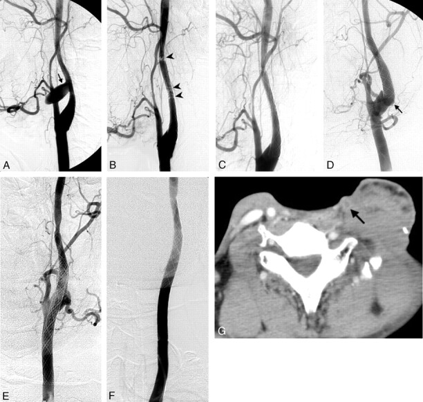 Fig 3.