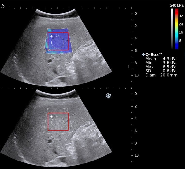 Fig. 2