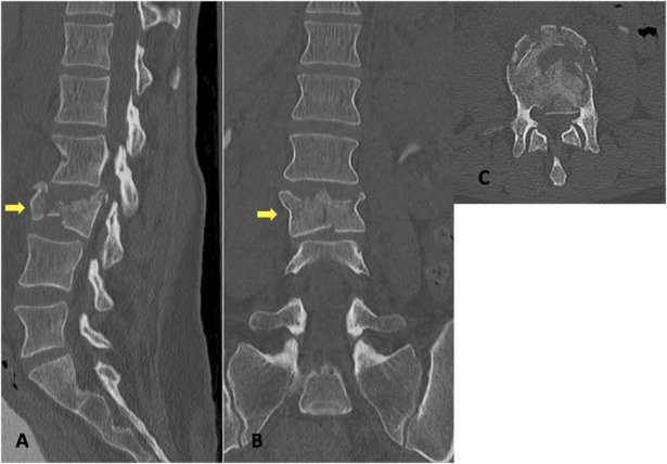 Fig. 2