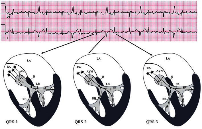 FIGURE 3