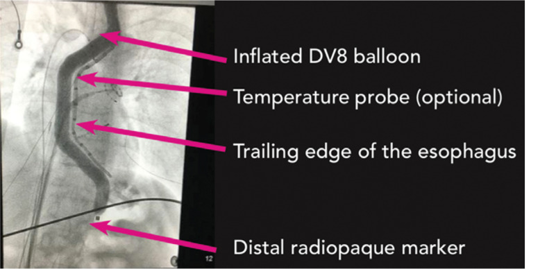 Figure 2: