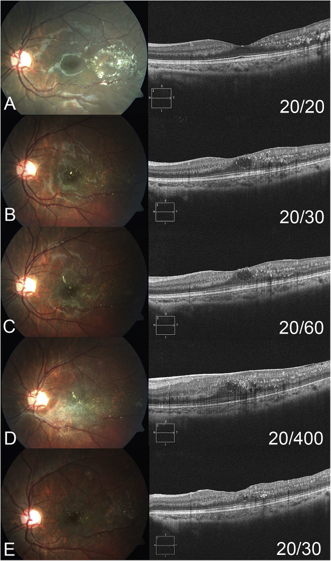 Fig. 1