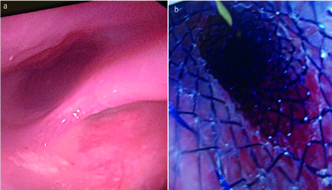 Figure 3. a, b