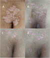 Fig. 2
