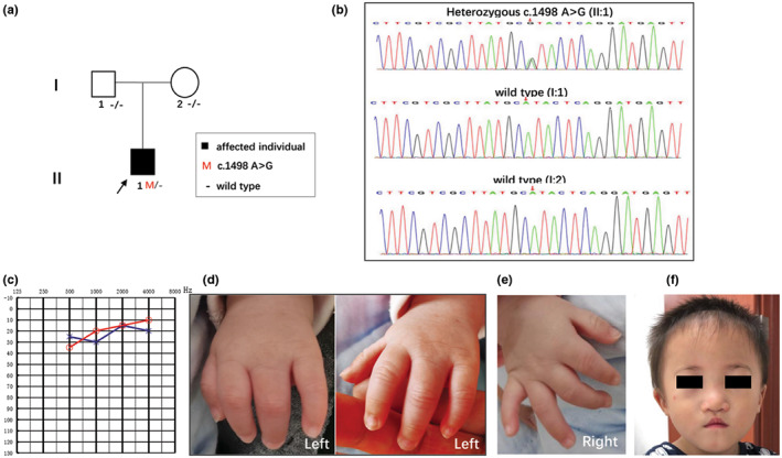 FIGURE 1