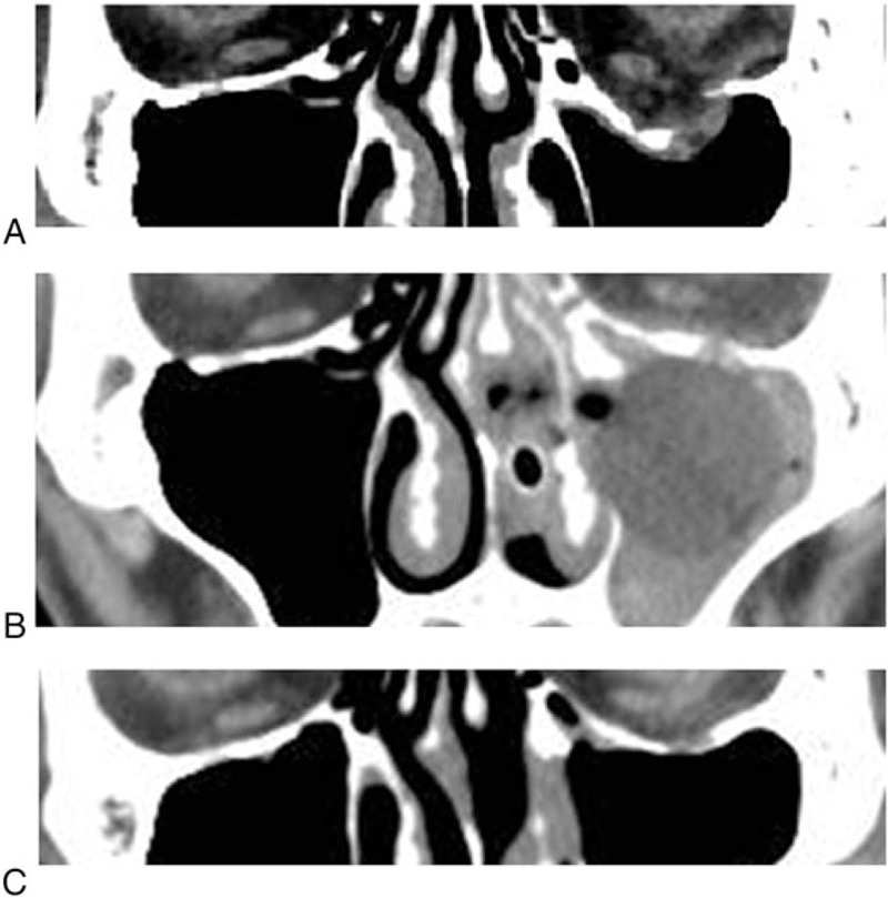 FIGURE 3