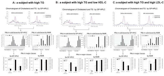 Supplementary Fig. 4. Representative GP-HPLC chromatograms directly monitoring cholesterol (pink line) and TG (blue line) as well as the PNs of each subclass and 3 major classes by GP-HPLC and NMR-LP3 before (open column) and after (closed column) pemafibrate administration