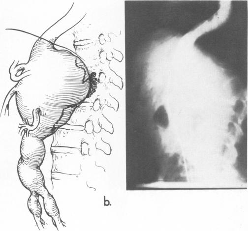 Fig. 10b.