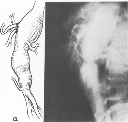 Fig. 9a.