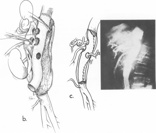 Fig. 9b.