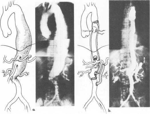 Fig. 18a,b.