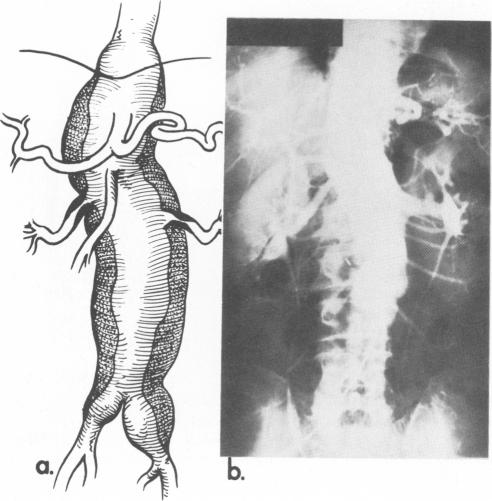 Fig. 15.