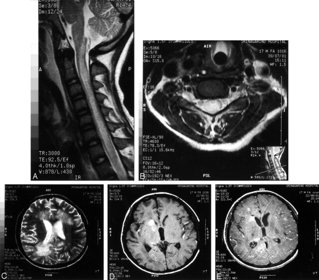 Fig 2.