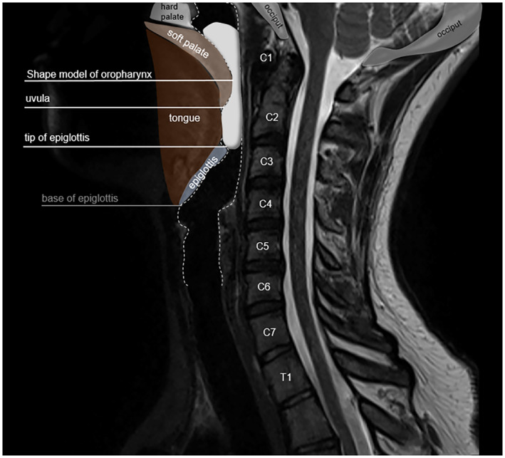 FIGURE 3