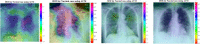 Fig. 10