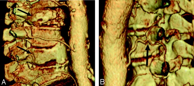 Fig 3.