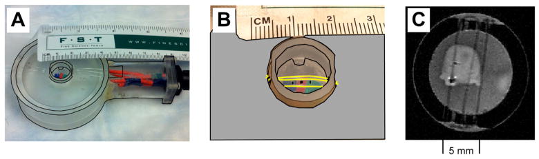 Fig. 2