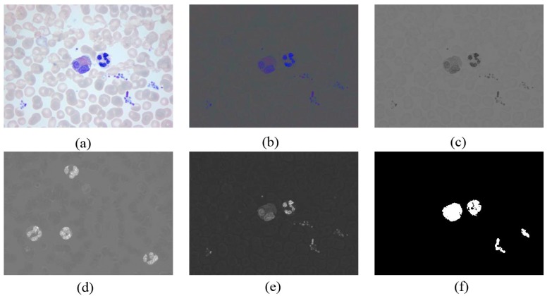 Figure 11