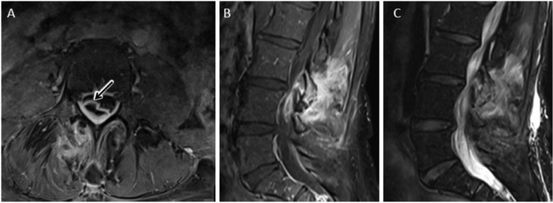 Figure 14.