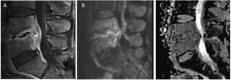 Figure 11.