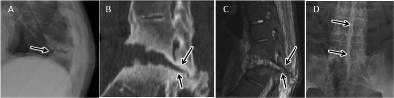 Figure 22.