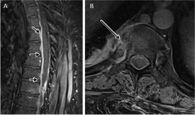 Figure 16.