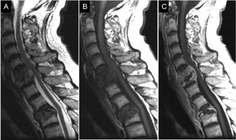 Figure 13.