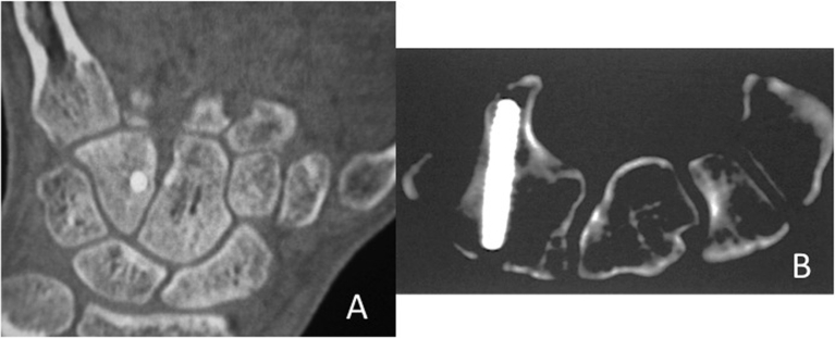 Fig. 3