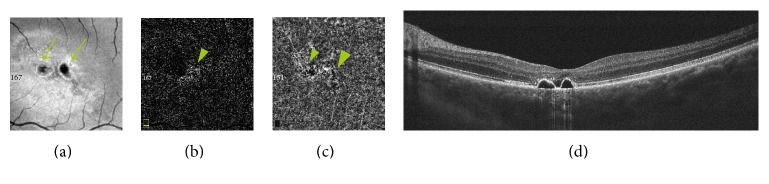 Figure 4