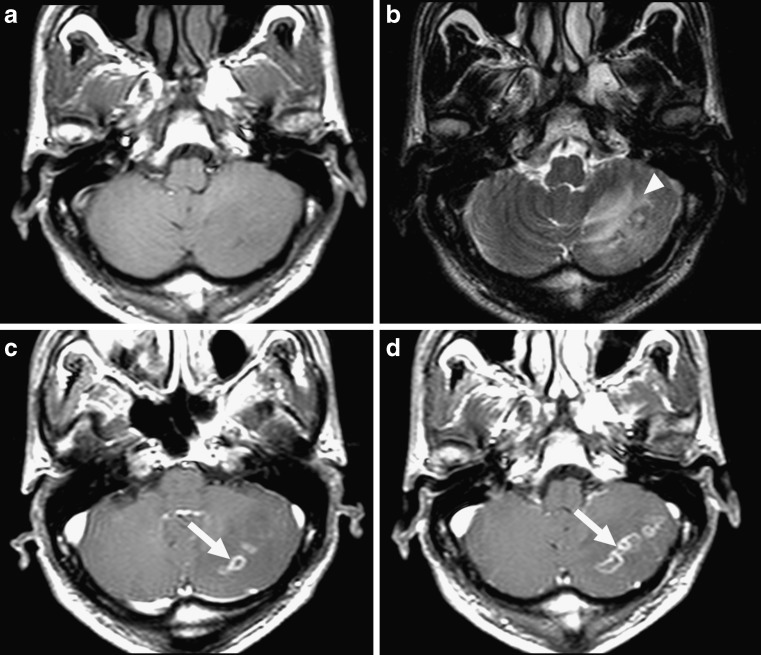 Fig. 1