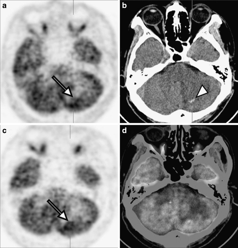 Fig. 2