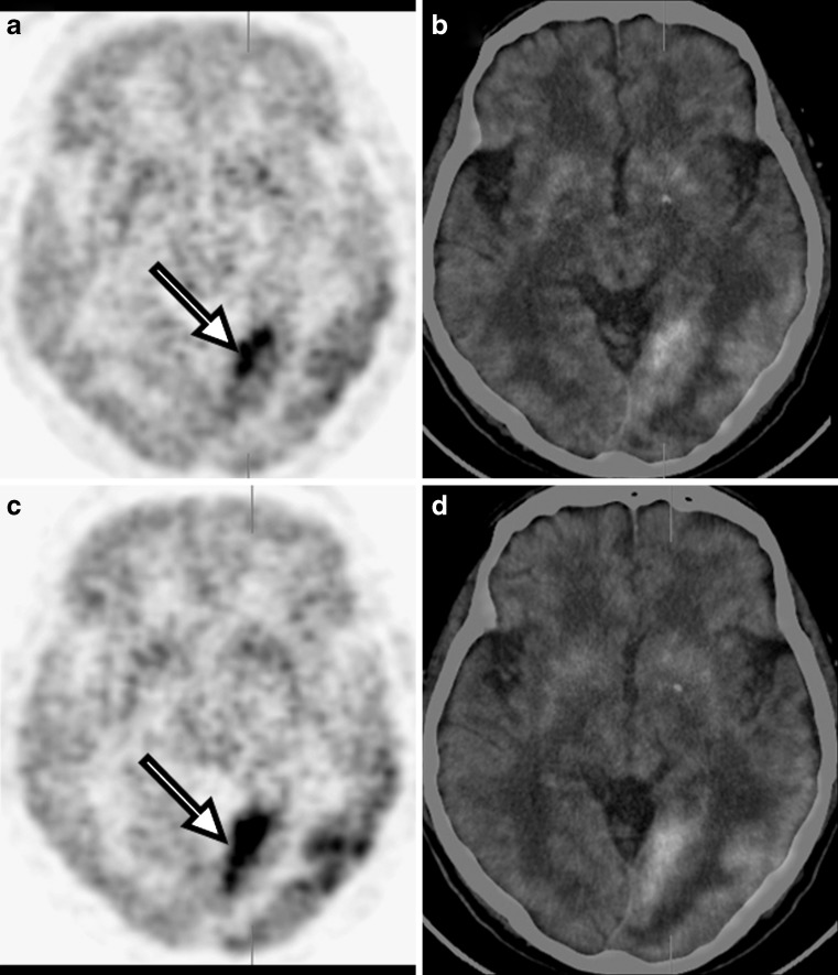 Fig. 4