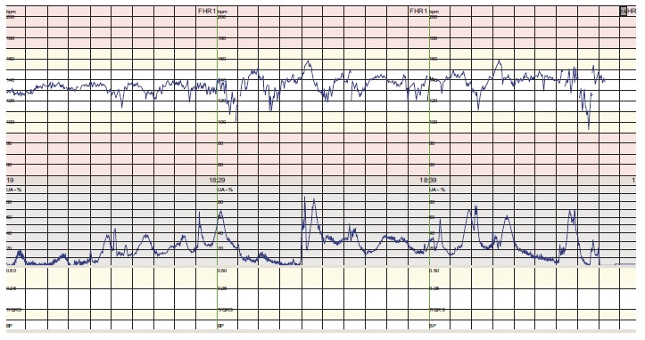 Fig. (1)