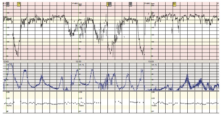 Fig. (2)